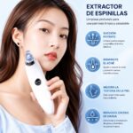 Extractor de Puntos Negros